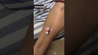 Properly cannula insertion shortvideo cannulation intravenous injection nursing trending [upl. by Eldoria]