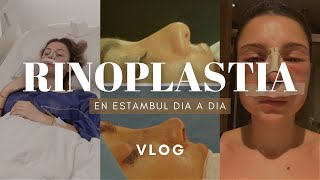 MI RINOPLASTIA EN ESTAMBULTURQUIA experiencia  VLOG DIA A DIA  rhinoplasty experience [upl. by Berti471]