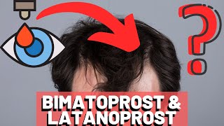 Glaucoma Drugs for Hair Loss The Curious Case of Bimatoprost amp Latanoprost [upl. by Nikita]