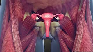 What is Intramural Uterine Fibroid Symptoms and Treatment  3D Guide [upl. by Shamrao]