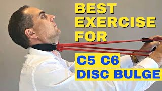 Best Exercises For C5 C6 Bulging Disc  C5 C6 Herniated Disc Exercises by Dr Walter Salubro [upl. by Pippo635]