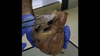 Dissection External features of heart part 1 [upl. by Raila35]