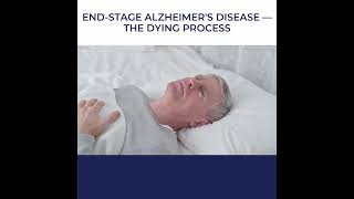 Uncovering the Reality of EndStage Alzheimers How the Dying Process Unfolds 😶‍🌫 [upl. by Anaila]