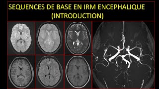 Séquences de base en IRM encéphalique Introduction [upl. by Sobmalarah280]