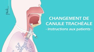 Changement de canule trachéale pour les patients  Animation  Fahl MedizintechnikVertrieb GmbH [upl. by Aivataj776]