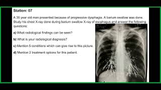 FCPS Mid Term Medicine Last Session BCPS OSCE Solve July24 [upl. by Angelis]