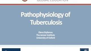 Pathophysiology of Tuberculosis by Elena Stylianou Oxford University [upl. by Ozan81]