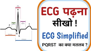 ecg reading in hindi  how to check ecg report in hindi  Electrocardiogram [upl. by Spracklen]