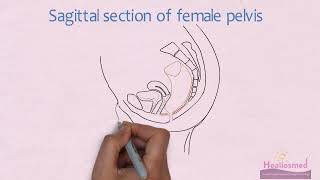 EASY TRICKS for Anatomical Body Planes and Sections DirectionPosition [upl. by Dolli531]