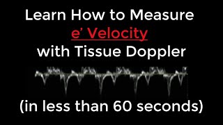 How to Measure e Velocity with Tissue Doppler for Diastolic Dysfunction Measurement in 60 Seconds [upl. by Marice]