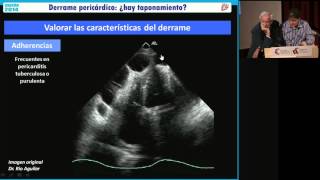 Máster de Técnicos en Ecocardiografía Tutoría 5 [upl. by Kathrine]