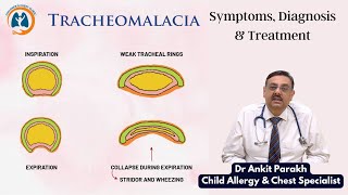 Tracheomalacia in children Symptoms Diagnosis amp Treatment I Dr Ankit Parakh Child Pulmonologist [upl. by Tnert735]