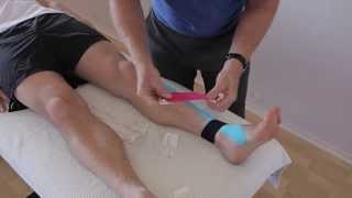 How to treat Anterior Shin Splints with Kinesiology taping [upl. by Alejoa]