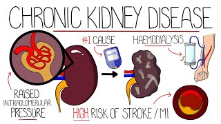 Understanding Chronic Kidney Disease CKD [upl. by Sidonius]