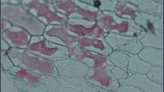 CEITICB Video Microscopía de Plasmólisis [upl. by Allerie]