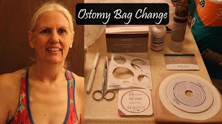 Ostomy Bag Change  How to Change an Ileostomy Bag [upl. by Glanti]