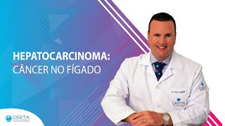 Hepatocarcinoma Câncer no Fígado [upl. by Legra169]