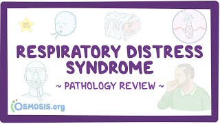 Respiratory distress syndrome Pathology Review [upl. by Asim]