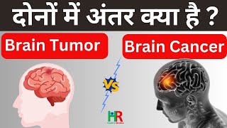 brain tumor and brain cancer in hindi  ब्रेन ट्यूमर और ब्रेन कैंसर की पूरी जानकारी हिंदी में [upl. by Annatsirhc]