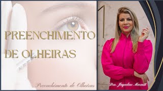 Você conhece o Preenchimento de Olheiras [upl. by Eleen]