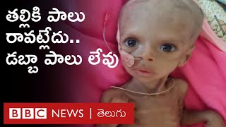 Tigray crisis  40 శాతం మంది పిల్లలు ఆకలితో అల్లాడుతున్నారు  BBC Telugu [upl. by Petulah2]