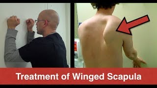 BEST Winged Scapula Exercises Fix Scapular Winging Treatment  Serratus Anterior Exercises [upl. by Aremahs988]