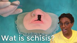 Wat is schisis [upl. by Carri]