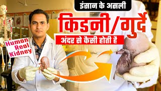 HUMAN REAL KIDNEY amp KIDNEY STONES  किडनीगुर्दे अंदर से कैसी होती है और इसमें पथरी कहाँ बनती है [upl. by Ajin202]