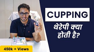 What Is Cupping Therapy  Benefits of Cupping Therapy  Do You Need Cupping Therapy [upl. by Arel219]