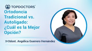 Ortodoncia Tradicional vs Autoligado ¿Cuál es la Mejor Opción [upl. by Euridice]