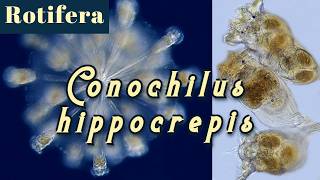 Colony of rotifers Conochilus hippocrepis Wheel animal [upl. by Shaughnessy]