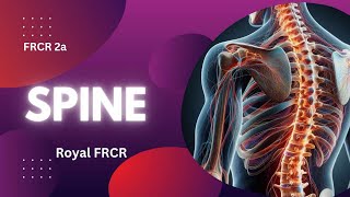 10  Neuroimaging for FRCR [upl. by Carrnan]