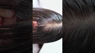 fast hair growth tips [upl. by Xuagram919]