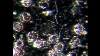 DARKFIELD MICROSCOPY BLOOD PARASITES [upl. by Arreic]