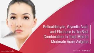 Retinaldehyde Glycolic Acid And Efectiose Combination is Effective in treating Acne Vulgaris [upl. by Teerprah]