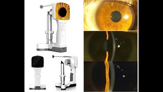 How Doctors Perform a Detailed Slit Lamp Examination [upl. by Adaven269]