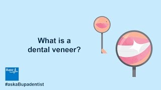 What is a dental veneer  Bupa Health [upl. by Piggy]