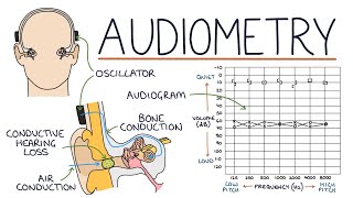 Understanding Audiometry and Audiograms [upl. by Ellennaj]