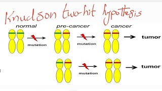 knudson two hit hypothesis compound heterozygote and consanguinty [upl. by Accisej362]