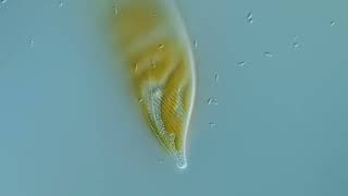 2 brackish Diatoms [upl. by Anwahsit]