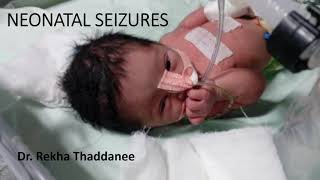 Neonatal Seizures  Pediatrics [upl. by Gherlein]