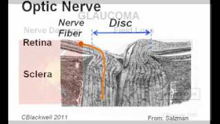 Eye Works 2 Image Retina Optic Nerve and Brain [upl. by Emina399]