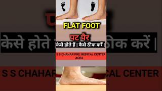 flatfoot pesplanus flatfoottreatment sscgdmedical2024 sscgdmedical2025 [upl. by Jonah]