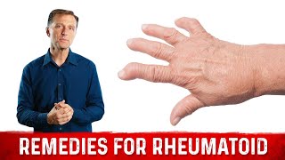 Best Remedies for Rheumatoid [upl. by Rosamund821]