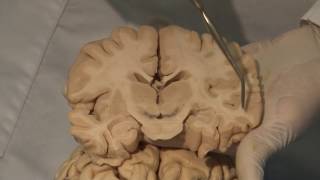 Cortical Localization Neuroanatomy Video Lab  Brain Dissections [upl. by Bachman]