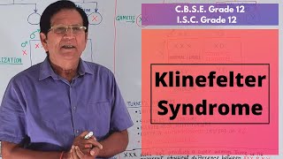 Klinefelter Syndrome  Grade 12 Biology [upl. by Dnomyad603]