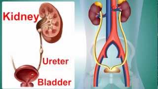 Kidney Stone or Calculus [upl. by Emanuele]