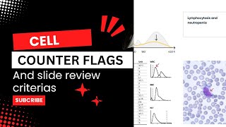 What are Cell Counterflags and Slide Review criteria  understanding CBC Automation [upl. by Aehsan]