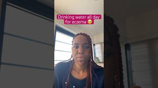 💧drinking water to heal eczema from the inside out dyshidroticeczema eczemawarrior skincare [upl. by Ydoj432]