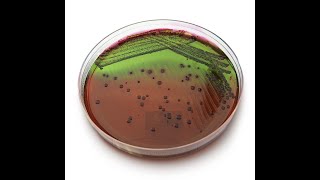 Contagem de coliformes totais termotolerantes e Escherichia coli [upl. by Yttocs]